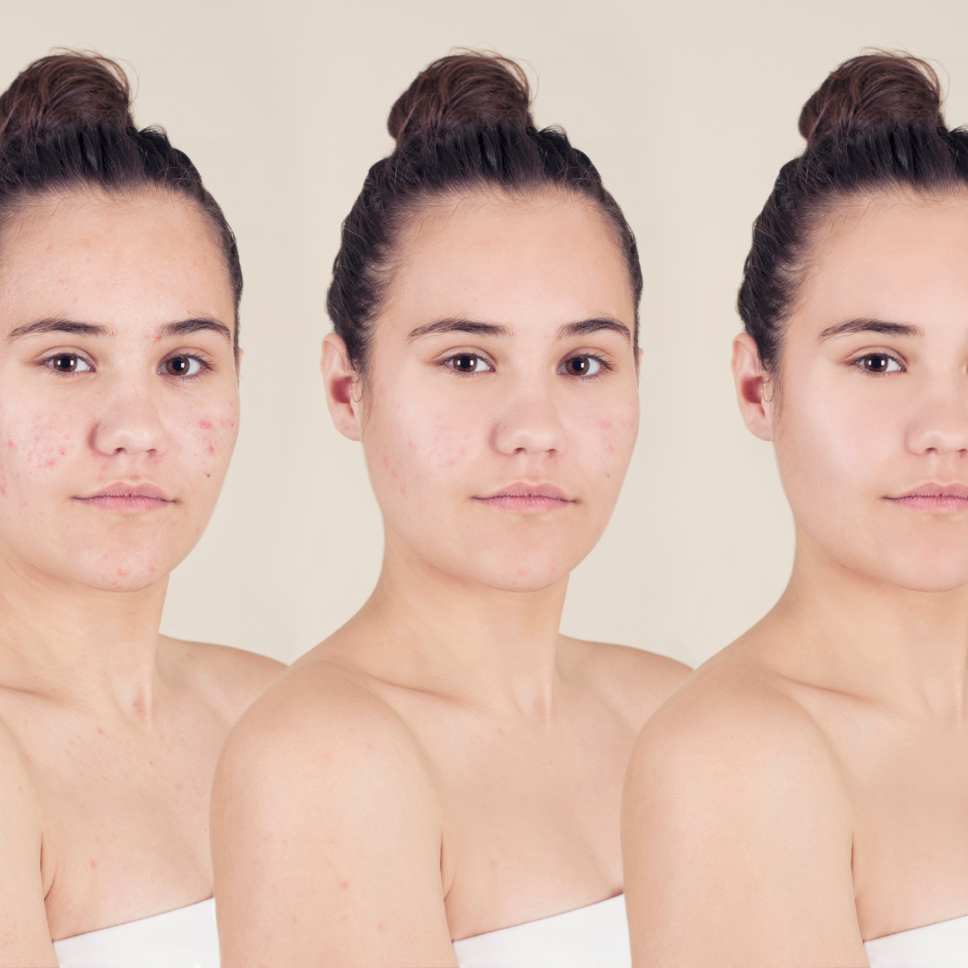 Three identical portraits of a young woman with her hair in a bun, shown from the shoulders up