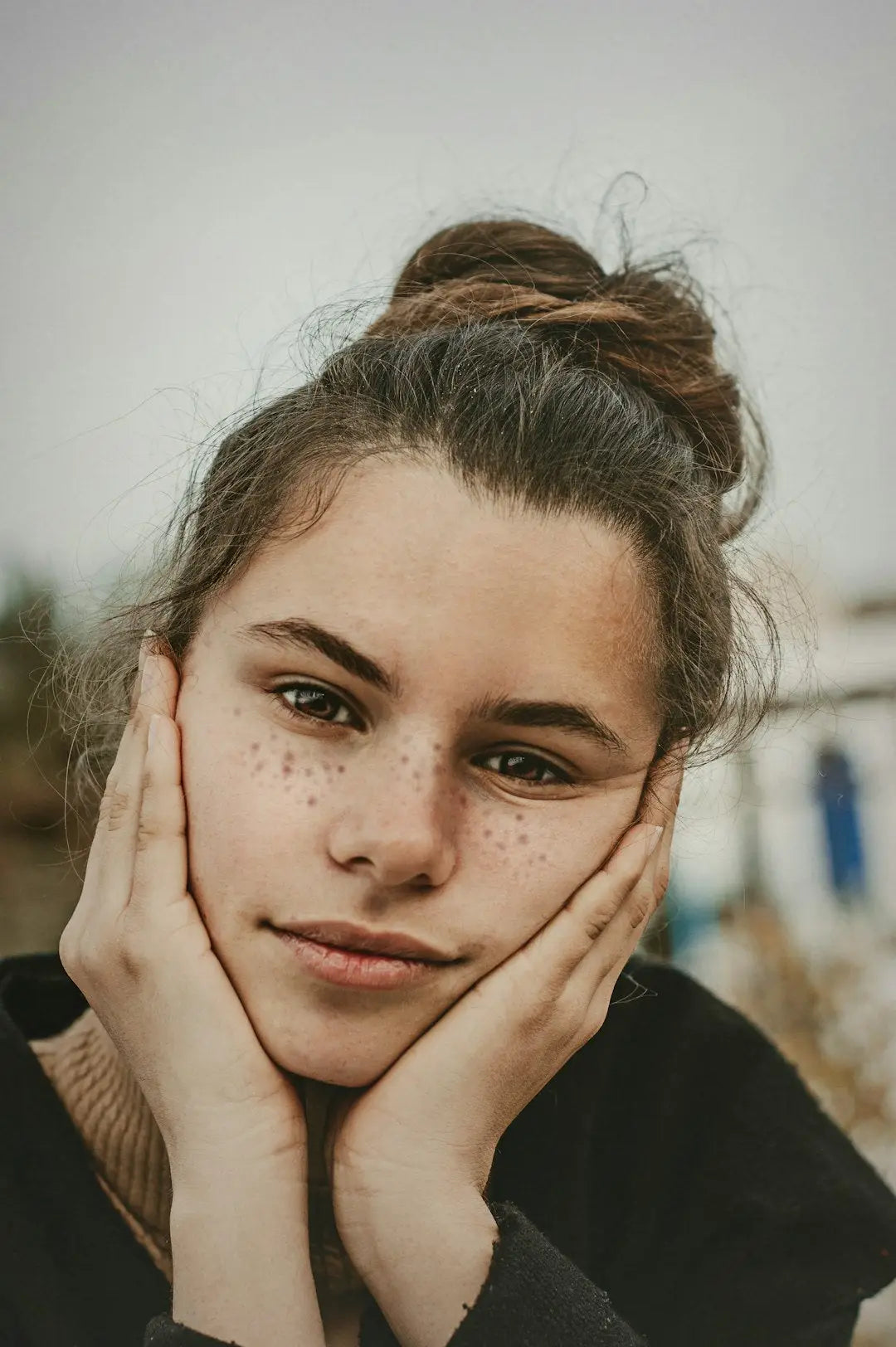 Unlocking Clear Skin: Skincare Solutions for Hormonal Acne